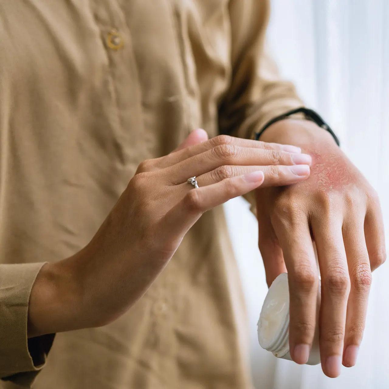 Neurodermitis verstehen