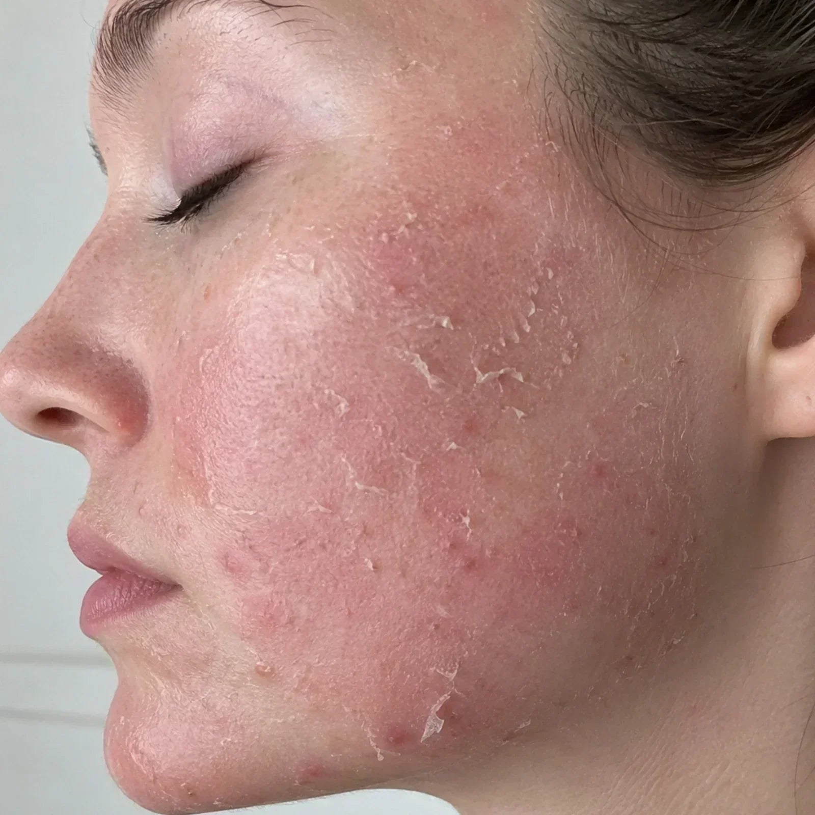 Retinol schädlich? Was der Anti Aging Hype verschweigt