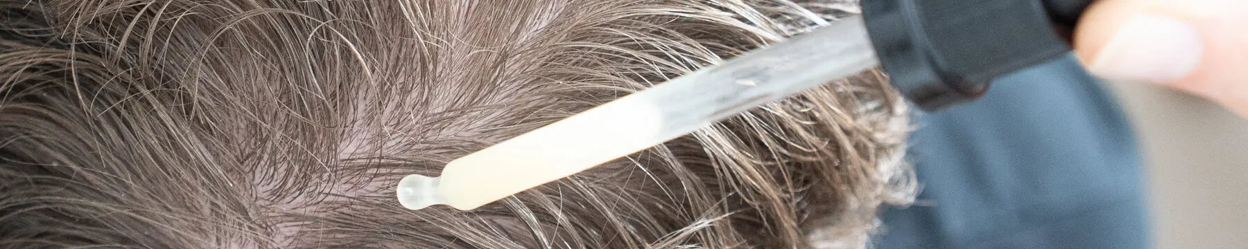 Haarausfall | Myrto Naturkosmetik